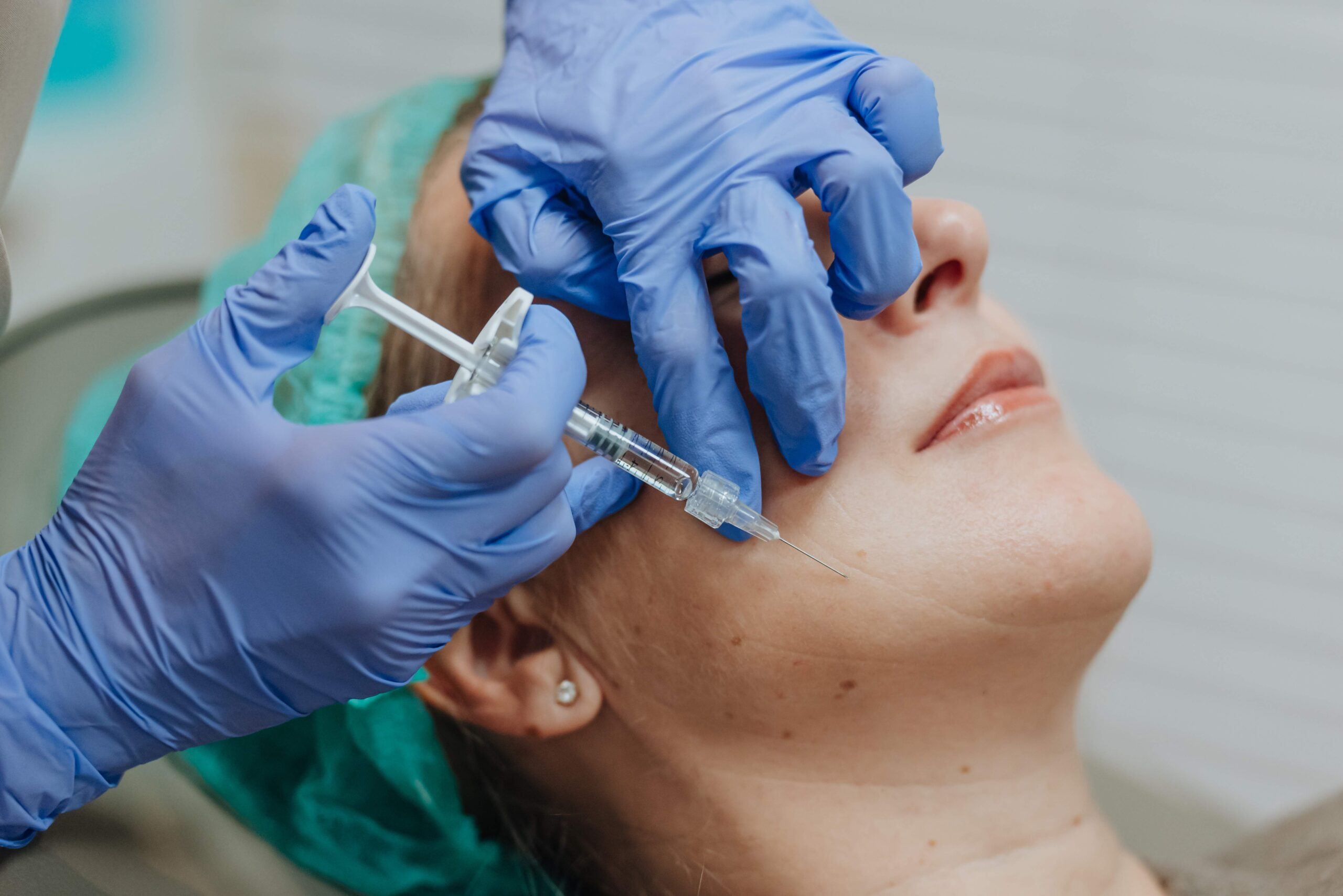 Biorevitalizacija