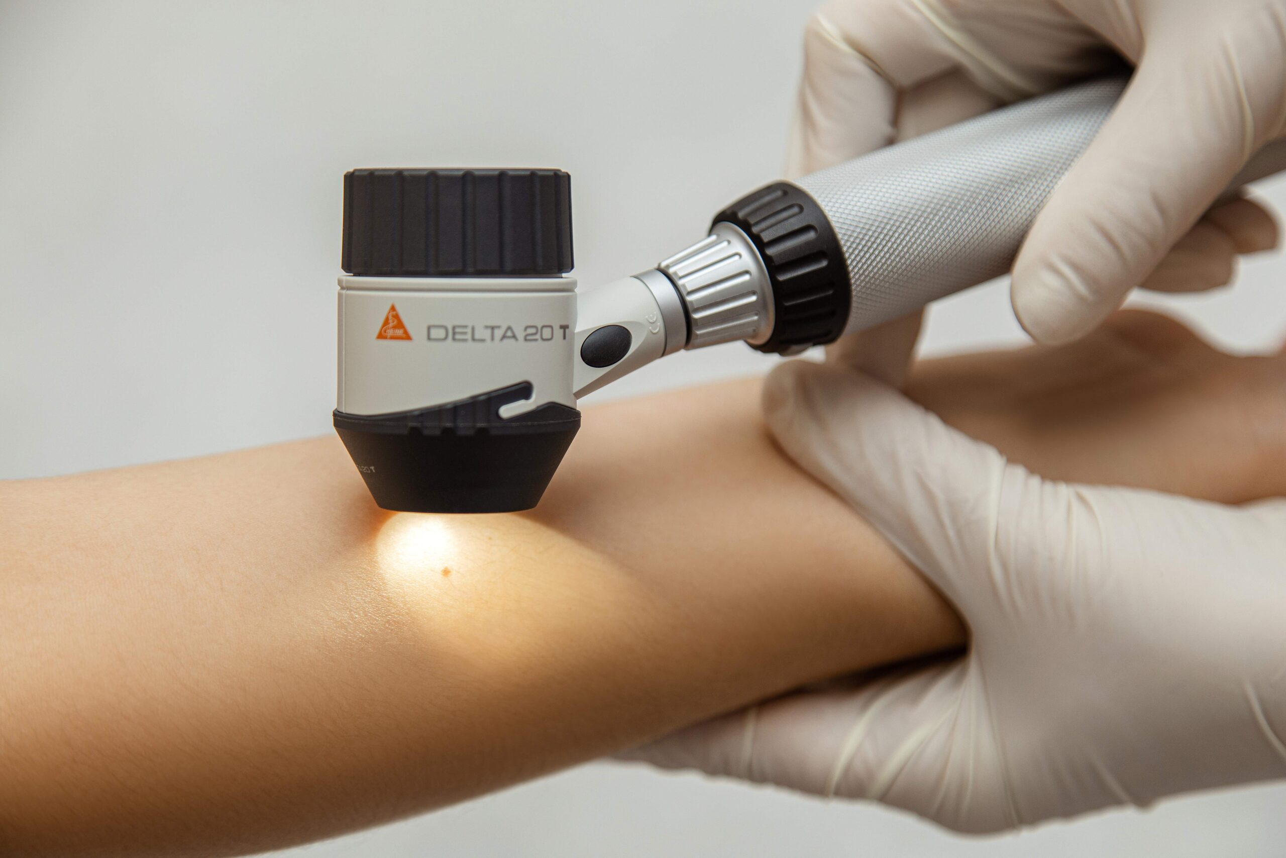 Gydytojos dermatologo konsultacija Skaiderma SkaiDerma